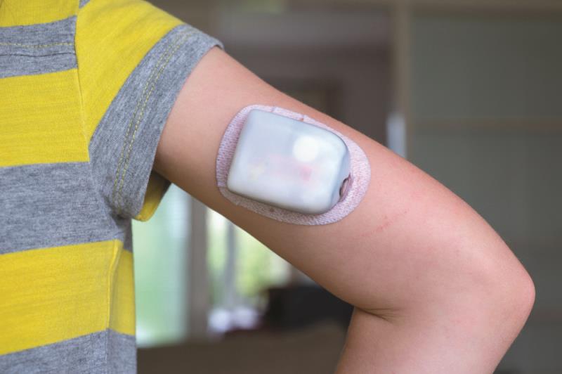 Suboptimal use of diabetes management technology in children and adolescents with T1D