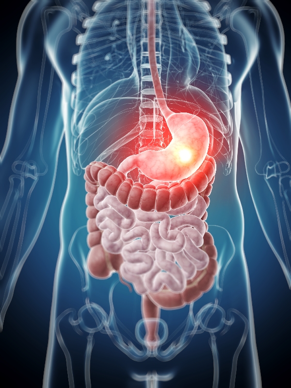 Intra-Abdominal Infections