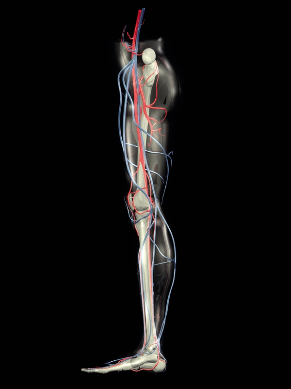 Peripheral Arterial Disease
