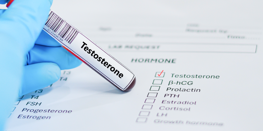 Hypogonadism in Males - Late-Onset_Diagnostics 1