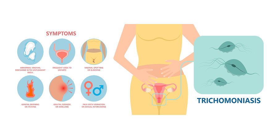 Vaginitis Trichomoniasis, Candidiasis, Bacterial Vaginosis_Initial Assesment 1