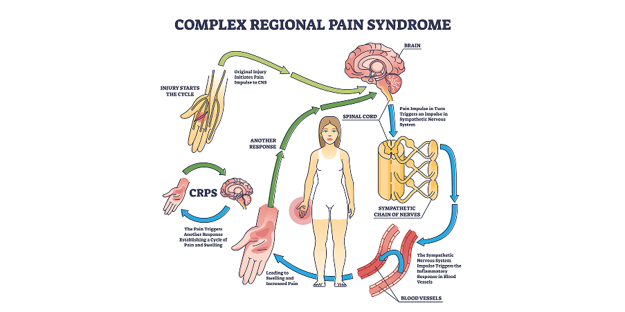 Neuropathic Pain_Disease Background 4