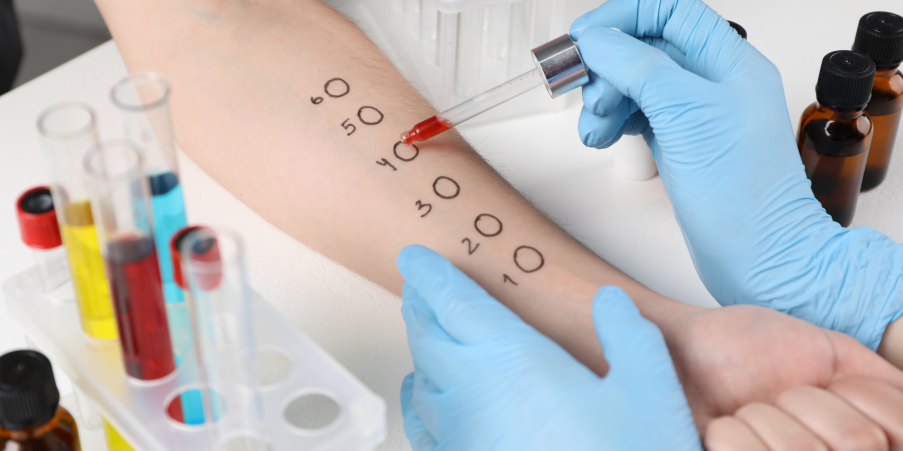Conjunctivitis - Allergic, Seasonal and Perennial_Diagnostics