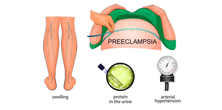 Hypertension in Pregnancy_Initial Assesment 2