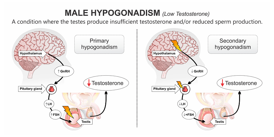 Hypogonadism in Males - Late-Onset_Diagnostics 2
