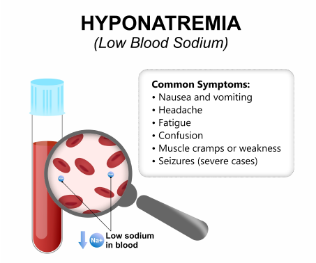 Hyponatremia_Initial Assesment 1